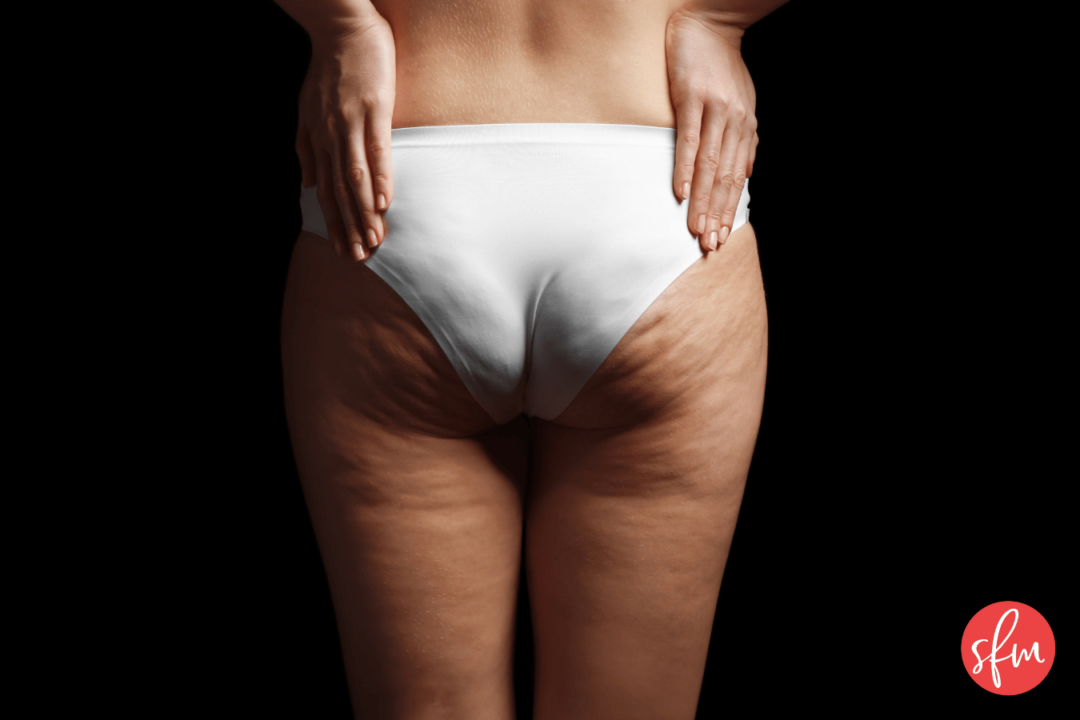 The topic of eliminating cellulite with fat loss.